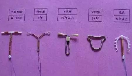 元宫型Cu365节育环到底是个啥？听医生朋友唠明白
